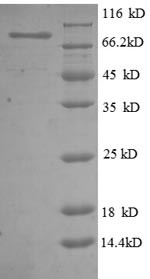 5&#039;-Nucleotidase (NT5E), partial, human, recombinant