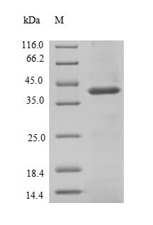 Signal-regulatory protein beta-1 (SIRPB1), partial, human, recombinant