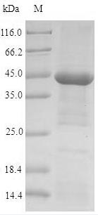 Acetylcholine receptor subunit alpha (CHRNA1), partial, human, recombinant