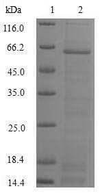 DNA fragmentation factor subunit alpha (DFFA), human, recombinant