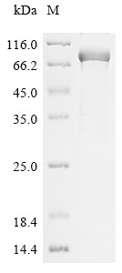 Myosin-6 (MYH6), partial, human, recombinant