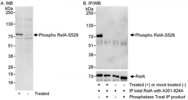 Anti-phospho-RelA (Ser529)