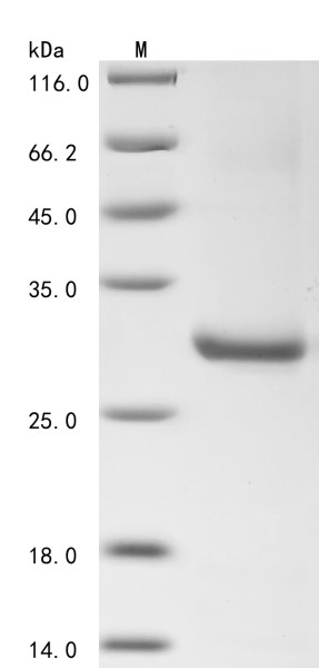 Nitric oxide synthase, inducible (NOS2),partial, human, recombinant