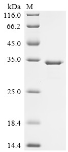 Uricase (Uox), rat, recombinant