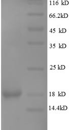 Leptin (LEP), partial, human, recombinant