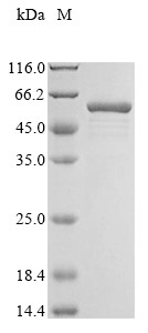 Annexin A5 (ANXA5), human, recombinant