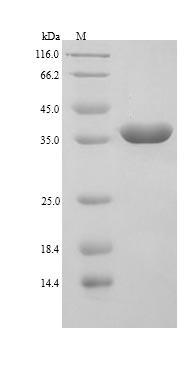 Galectin-9 (LGALS9), human, recombinant