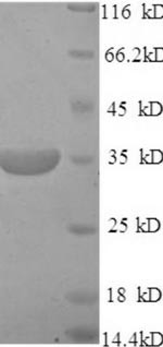 Membrane cofactor protein (Cd46), partial, mouse, recombinant