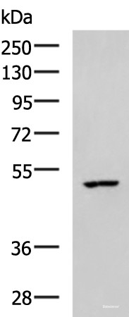 Anti-CKMT1A/CKMT1B