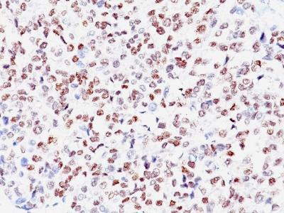 Anti-Microphthalmia Transcription Factor (MITF)(Clone: SPM290)