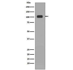 Anti-LSD1 / Lysine-Specific Demethylase 1, clone DID-11