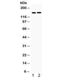 Anti-HDAC6