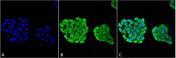 Anti-HSP70 Monoclonal Antibody (Clone: 3A3) - RPE