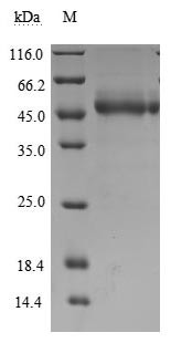 T-cell immunoreceptor with Ig and ITIM domains (TIGIT), partial (Active), human, recombinant