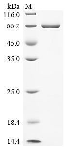 Signal transducer and activator of transcription 3 (STAT3), partial, human, recombinant