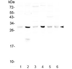 Anti-DCK / Deoxycytidine kinase