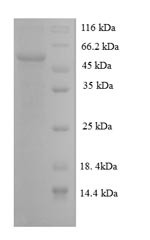 Regucalcin (Rgn), rat, recombinant