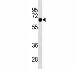 Anti-SOX9, clone 334CT39.1.4