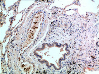 Anti-MAPK14 Monoclonal