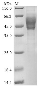 Interleukin-13 (IL13), partial, human, recombinant