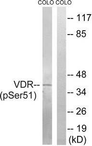 Anti-Phospho-VDR (Ser51)