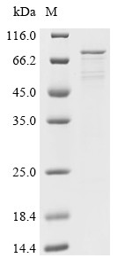 Atrial natriuretic peptide receptor 1 (NPR1), partial, human, recombinant