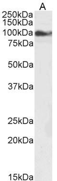 Anti-TRPC6, C-terminal