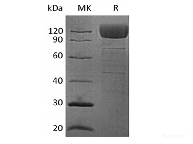 platelet membrane glycoprotein IV/CD36/SR-B3 Fc Chimera Protein(Fc Tag ...