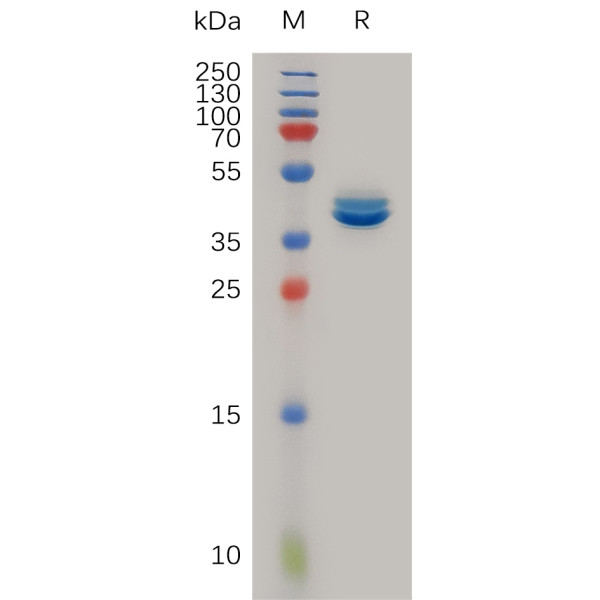 Human CCL2 Protein, hFc Tag