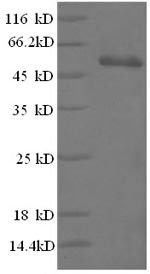 High mobility group protein B1 (HMGB1), partial, human, recombinant