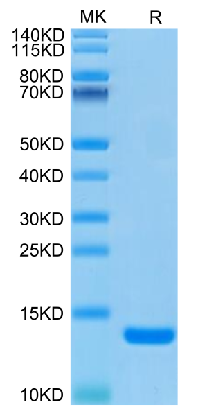 Human B2M/beta 2-Microglobulin Protein