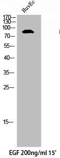 Anti-Phospho-AXL (Y691)