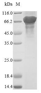 Acetyl-CoA carboxylase (ACC1), partial, Saccharomyces cerevisiae, recombinant