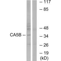 Anti-CA5B