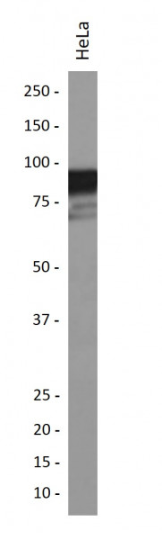 Anti-phospho-Glycogen Synthase 1 (Ser641)
