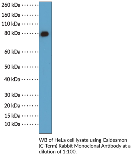 Anti-Caldesmon (C-Term) Rabbit Monoclonal Antibody (RM396) | Cayman ...