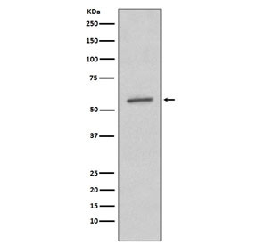 Anti-SGK1 / SGK, clone EHF-19