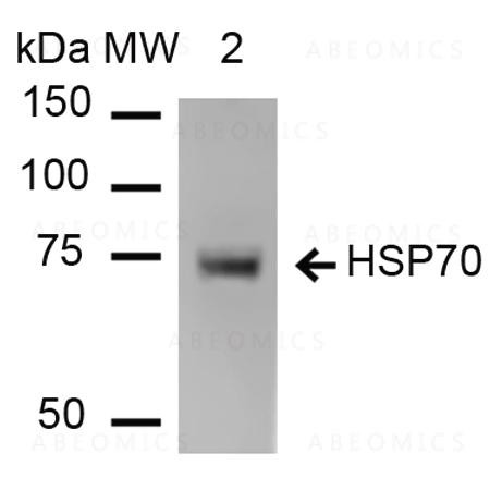 Anti-HSP70 Monoclonal Antibody (Clone: 1H11) - ATTO 594