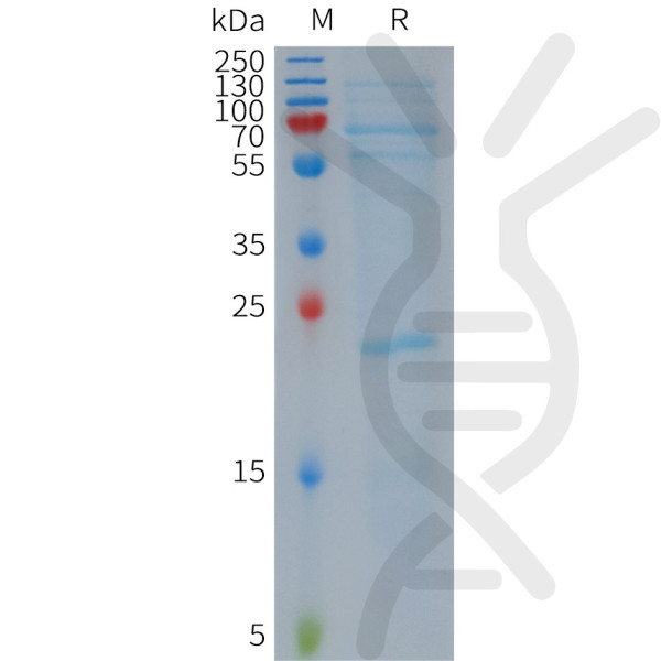 Human NLRP3 Protein, Flag Tag