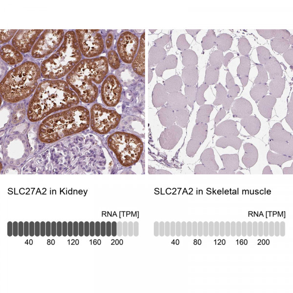 Anti-SLC27A2