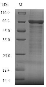 Fc receptor-like protein 4 (FCRL4), partial, human, recombinant