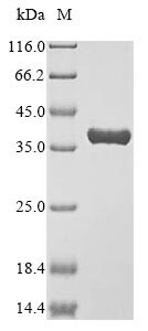 Annexin A4 (Anxa4), partial, mouse, recombinant