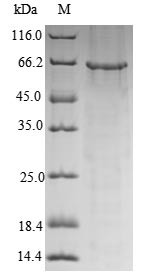 Glutamate receptor ionotropic, NMDA 1 (GRIN1),partial, human, recombinant