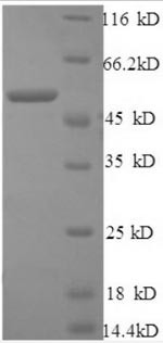 Cathepsin B (CTSB), partial, human, recombinant