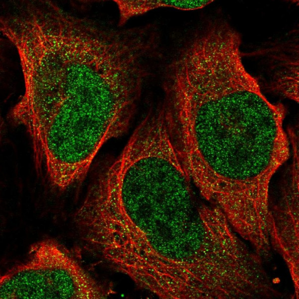 Anti-ATP6V1A