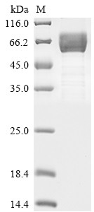 Hepatitis A virus cellular receptor 2 (HAVCR2), partial, human, recombinant