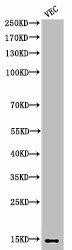 Anti-acetyl-Histone H2B (K5)