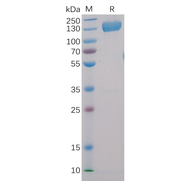 Human CD22 Protein, hFc-His Tag