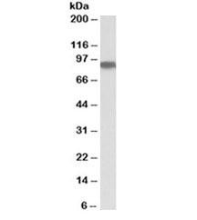 Anti-Aconitase 2