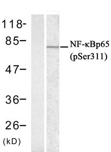 Anti-Phospho-RELA (Ser311)